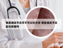 银屑病关节炎可不可以吃月饼 银屑病关节炎能吃螃蟹吗