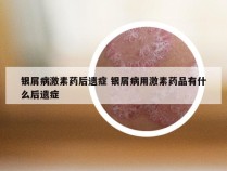 银屑病激素药后遗症 银屑病用激素药品有什么后遗症