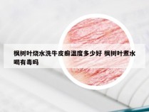 枫树叶烧水洗牛皮癣温度多少好 枫树叶煮水喝有毒吗