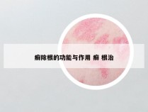 癣除根的功能与作用 癣 根治