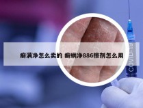 癣满净怎么卖的 癣螨净886擦剂怎么用