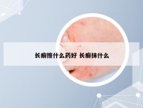 长癣擦什么药好 长癣抹什么