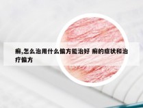 癣,怎么治用什么偏方能治好 癣的症状和治疗偏方