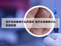 治疗头皮癣用什么药膏好 治疗头皮癣用什么药膏好使