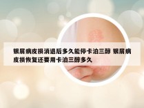 银屑病皮损消退后多久能停卡泊三醇 银屑病皮损恢复还要用卡泊三醇多久