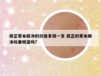 修正草本藓净的价格多钱一支 修正的草本癣净效果明显吗?