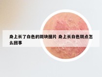 身上长了白色的斑块图片 身上长白色斑点怎么回事