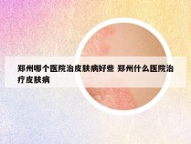 郑州哪个医院治皮肤病好些 郑州什么医院治疗皮肤病