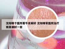 沈阳哪个医院看牛皮癣好 沈阳哪家医院治疗银屑病好一些