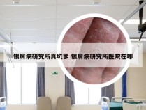 银屑病研究所真坑爹 银屑病研究所医院在哪