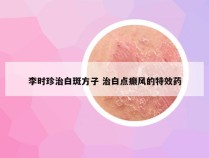 李时珍治白斑方子 治白点癫风的特效药