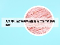 九江可以治疗白癜风的医院 九江治疗皮肤病医院