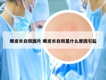 眼皮长白斑图片 眼皮长白斑是什么原因引起