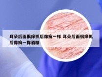 耳朵后面很痒抓后像癣一样 耳朵后面很痒抓后像癣一样酒精