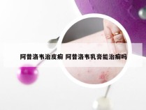 阿昔洛韦治皮癣 阿昔洛韦乳膏能治癣吗