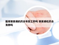 服用银屑病的药会导致乙肝吗 银屑病吃药会发胖吗