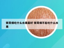 银霄病吃什么水果最好 银霄病不能吃什么水果