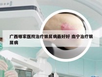 广西哪家医院治疗银屑病最好好 南宁治疗银屑病