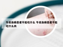 牛皮血癣患者不能吃什么 牛皮血癣患者不能吃什么肉