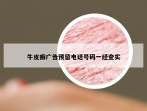 牛皮癣广告预留电话号码一经查实