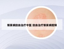 银屑病放血治疗中医 放血治疗银屑病视频