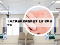 北京皮肤病银屑病在线医生 北京 银屑病 专家