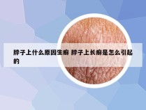 脖子上什么原因生癣 脖子上长癣是怎么引起的