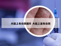 大腿上有白斑图片 大腿上面有白斑