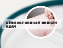 儿童银屑病吃的银屑颗粒用量 银屑颗粒治疗银屑病吗