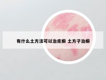 有什么土方法可以治皮癣 土方子治癣