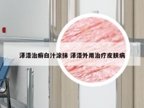 泽漆治癣白汁涂抹 泽漆外用治疗皮肤病