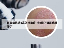 银屑病抗链o高怎样治疗 抗o降了银屑病就好了