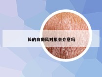 长的白癜风对象会介意吗