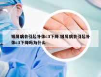 银屑病会引起补体c3下降 银屑病会引起补体c3下降吗为什么