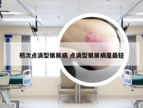 初次点滴型银屑病 点滴型银屑病是最轻