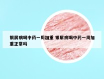 银屑病喝中药一周加重 银屑病喝中药一周加重正常吗