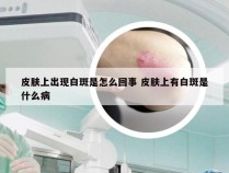 皮肤上出现白斑是怎么回事 皮肤上有白斑是什么病