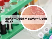 银屑病用什么泡澡最好 银屑病用什么泡澡最好的方法