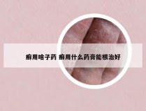 癣用啥子药 癣用什么药膏能根治好