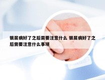 银屑病好了之后需要注意什么 银屑病好了之后需要注意什么事项