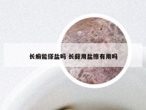 长癣能搽盐吗 长藓用盐擦有用吗