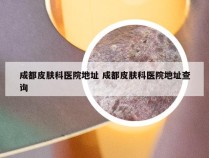 成都皮肤科医院地址 成都皮肤科医院地址查询