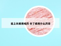 腚上长癣用啥药 长了癣用什么药膏