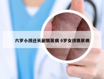 六岁小孩还长副银屑病 6岁女孩银屑病