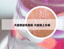 大腿根部有瘾癣 大腿根上长癣