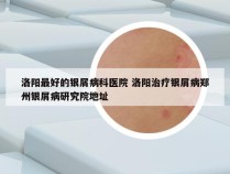 洛阳最好的银屑病科医院 洛阳治疗银屑病郑州银屑病研究院地址