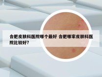 合肥皮肤科医院哪个最好 合肥哪家皮肤科医院比较好?