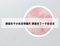 脚底长个小白点带图片 脚底长了一个白点点