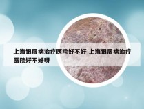 上海银屑病治疗医院好不好 上海银屑病治疗医院好不好呀