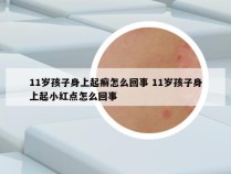 11岁孩子身上起癣怎么回事 11岁孩子身上起小红点怎么回事